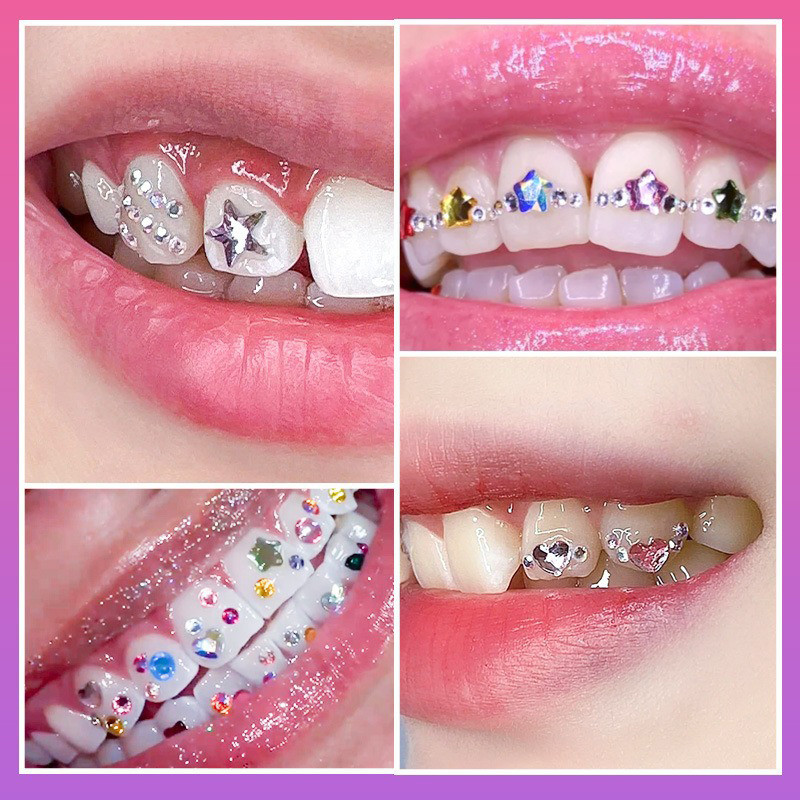 NUEVO Kit Profesional de Gemas - Tooth Gem Kit reseña y precio