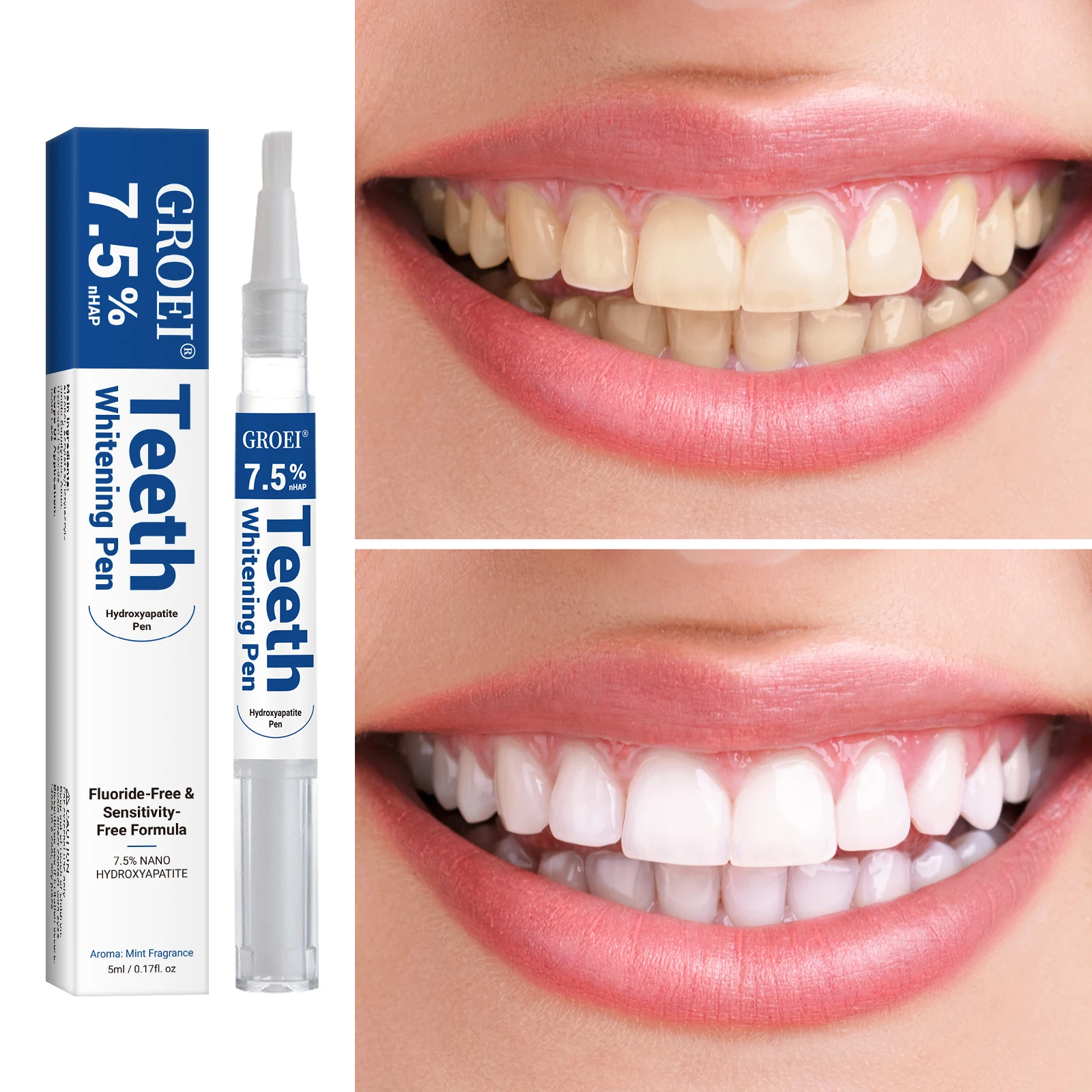Pluma blanqueadora de dientes  - Teeth Whitening Gels Used By Dentists reseña y precio