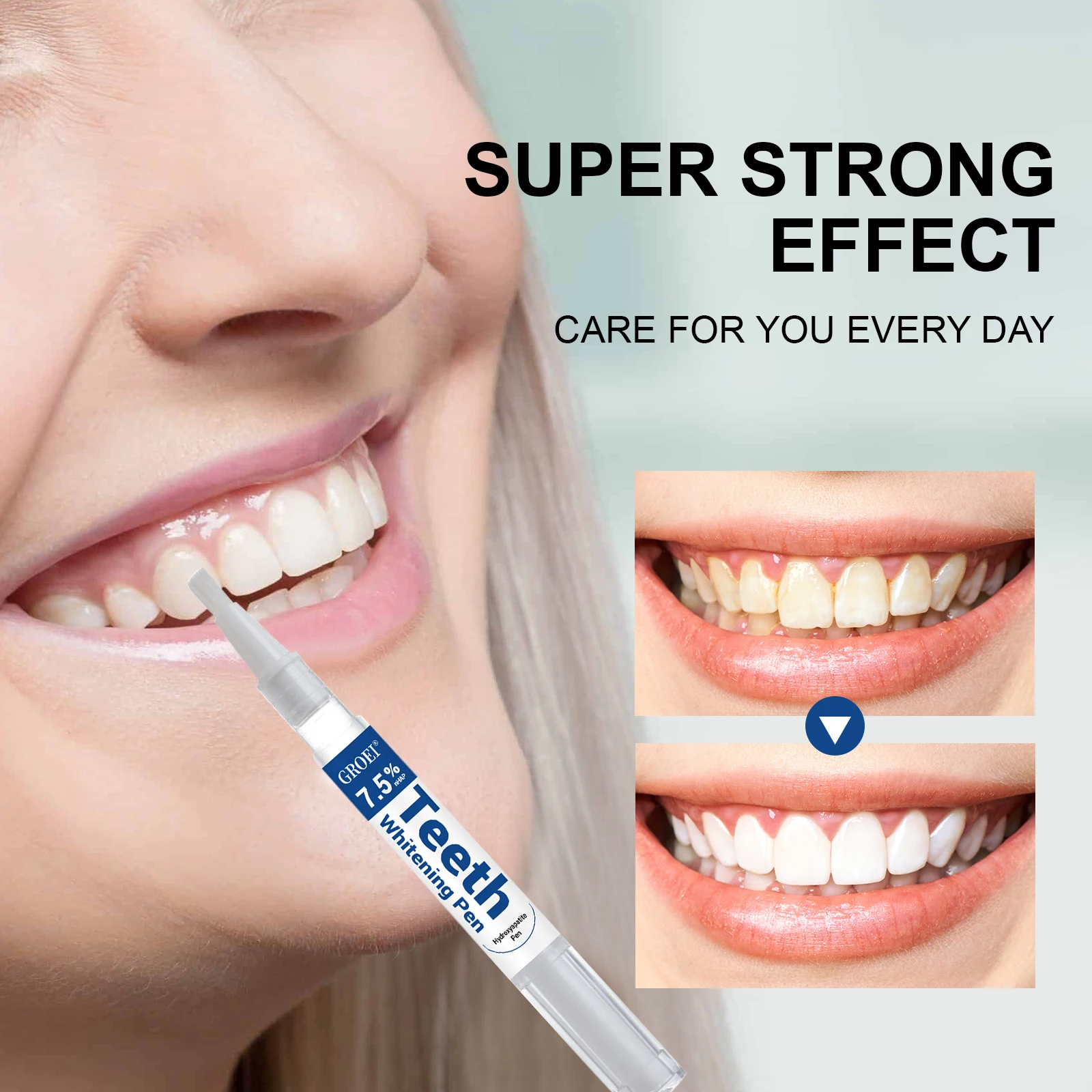 Pluma blanqueadora de dientes  - Teeth Whitening Gels Used By Dentists reseña y precio