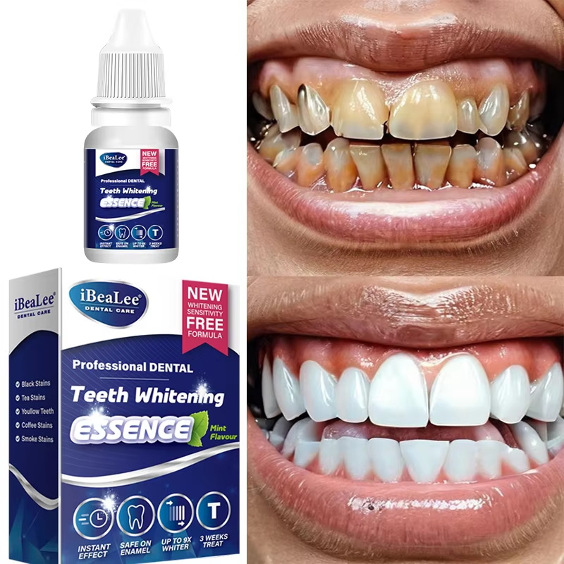 Esencia blanqueadora de diente - Teeth Whitening Serum reseña y precio