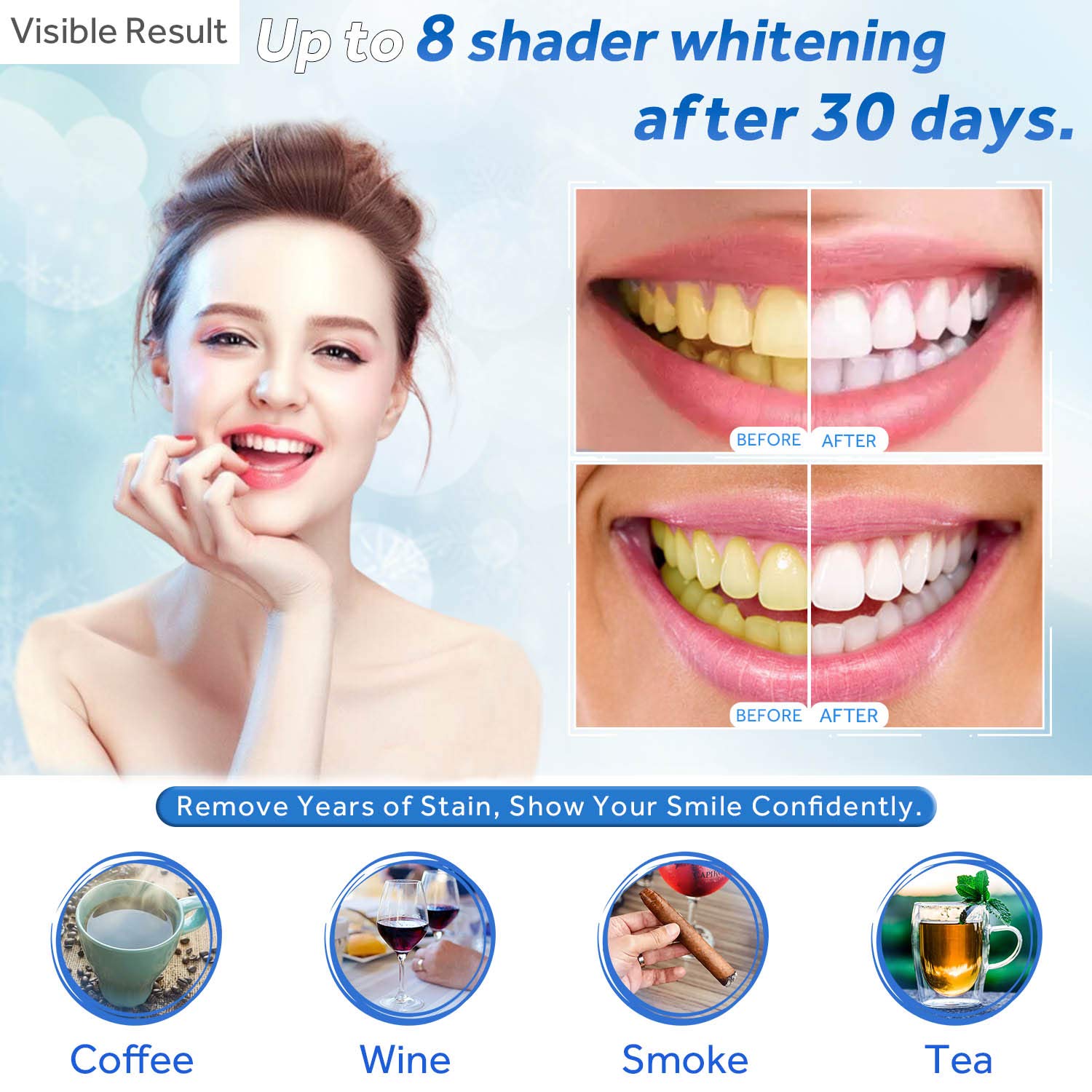 Jeringa de repuesto de Gel par - Teeth Whitening Gels Used By Dentists reseña y precio