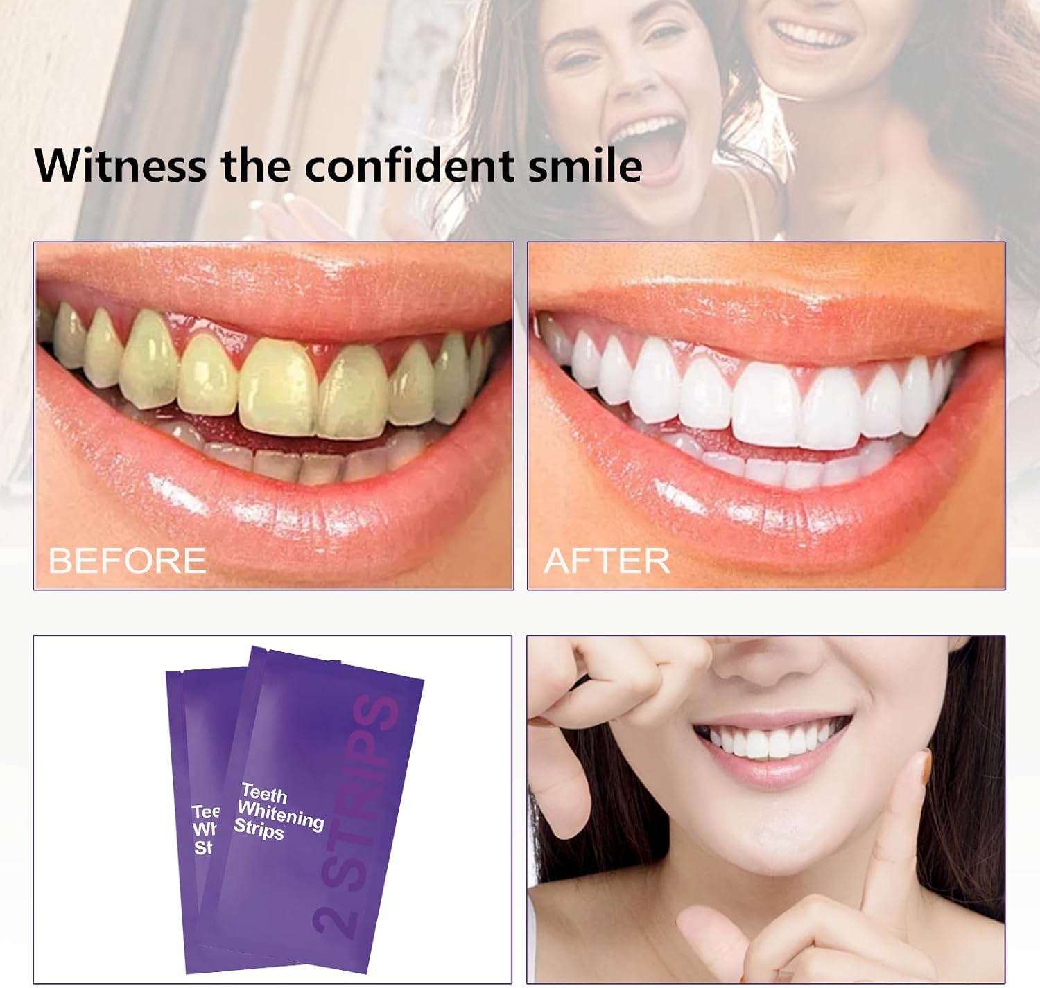 Kit de blanqueamiento dental m - Teeth Whitening Gel Refills reseña y precio