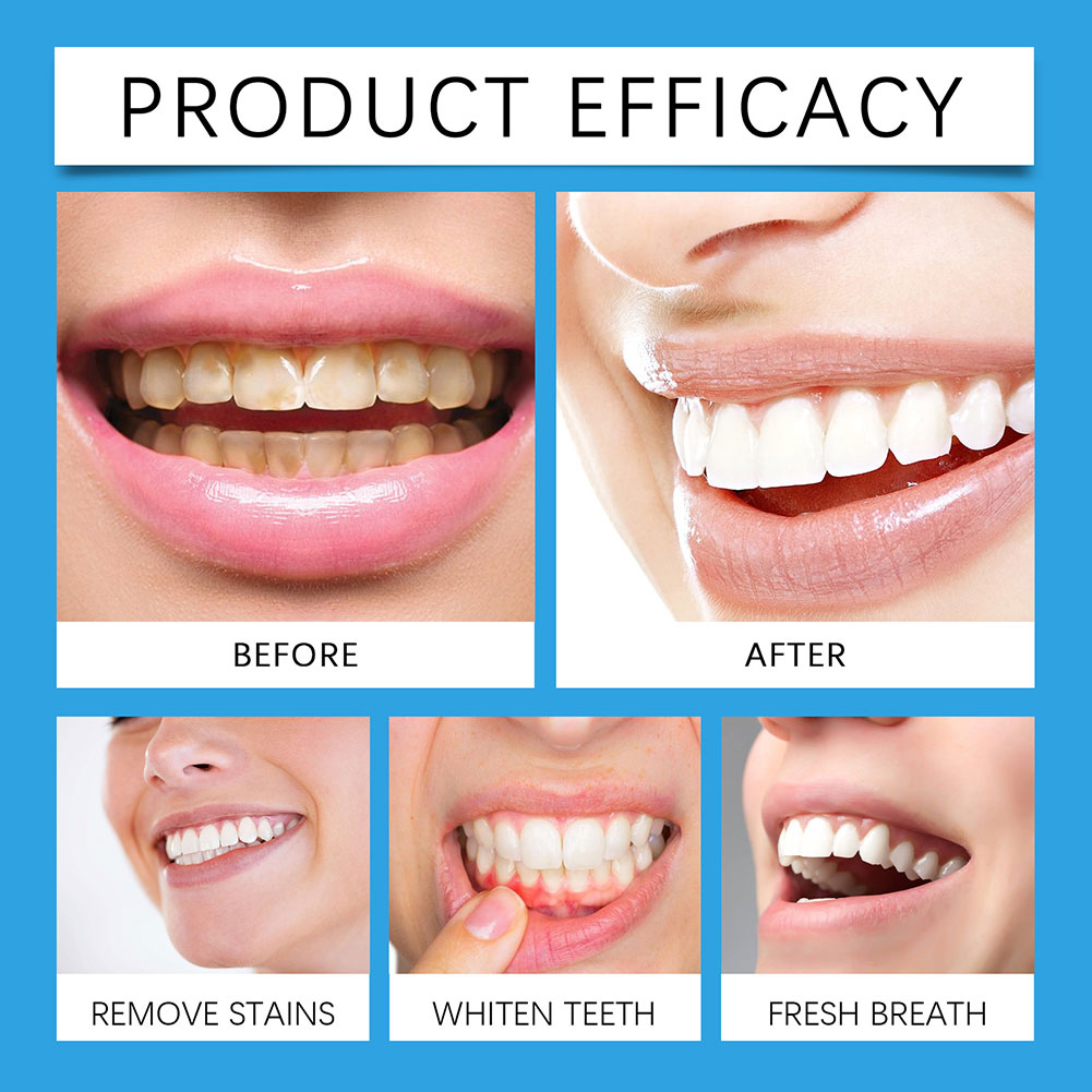 Eliminador de manchas de dient - Teeth Whitening For Photos reseña y precio